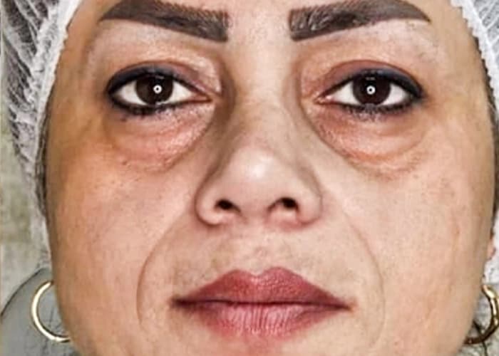 بعد